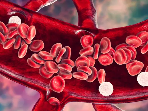 Umělé cévy – vynález, který denně zachraňuje tisíce životů
