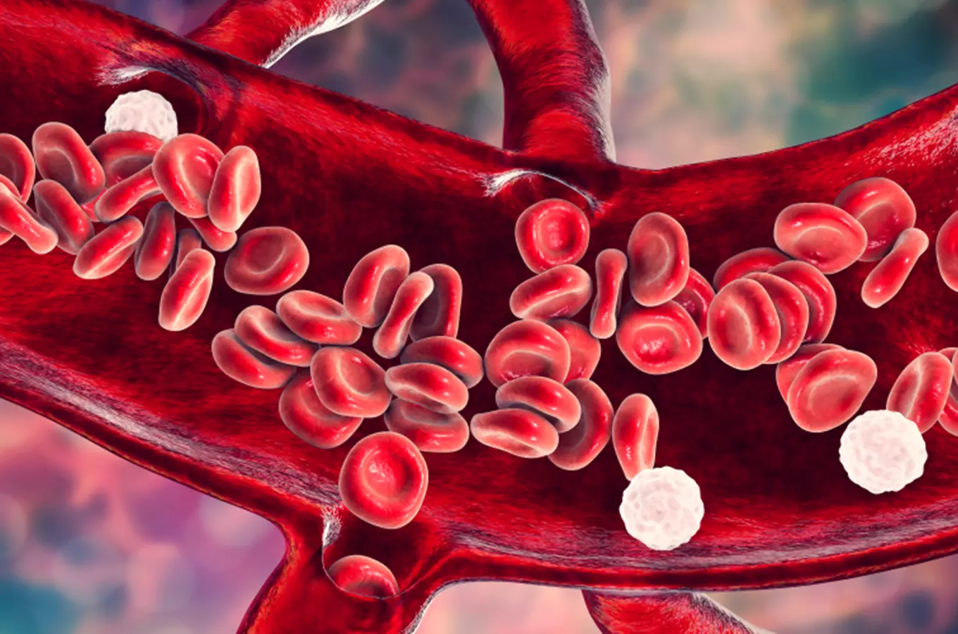 Umělé cévy – vynález, který denně zachraňuje tisíce životů